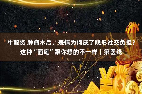 牛配资 肿瘤术后，表情为何成了隐形社交负担？这种“面瘫”跟你想的不一样｜第医线